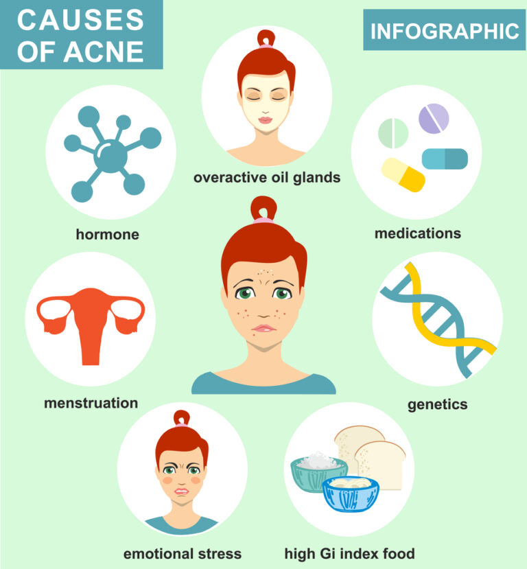 Is The Acne Face Map Legit? Important Facts You Need To Know